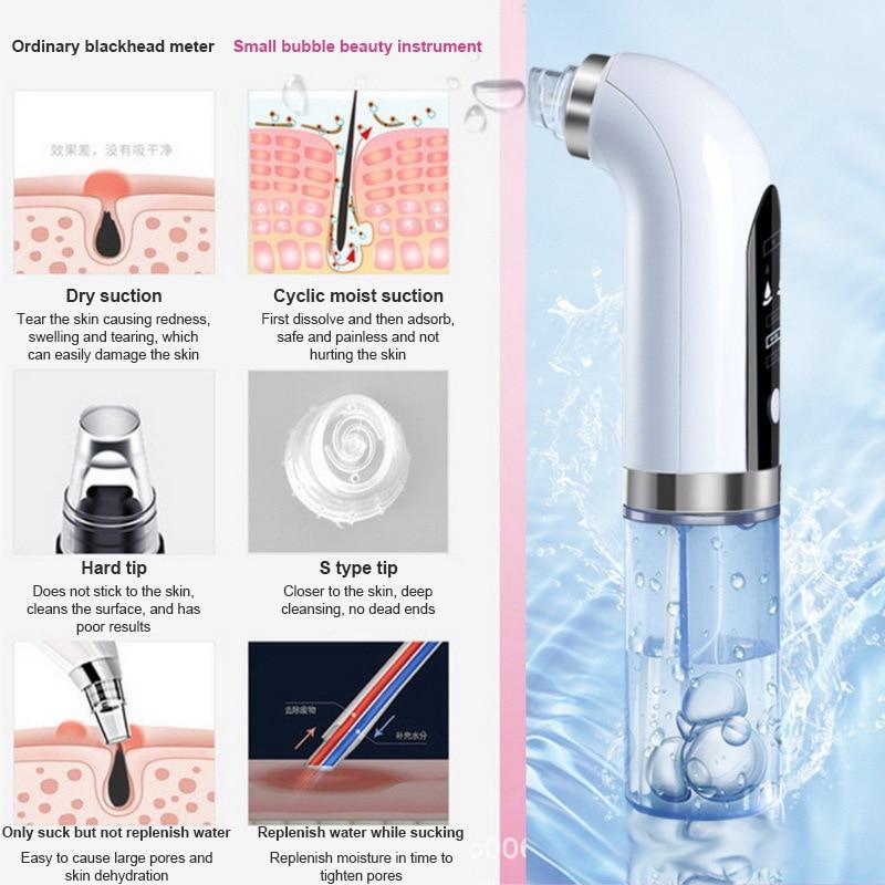 Electric Blackhead Remover | Vacuum Remover | The Cosmetic Obsession