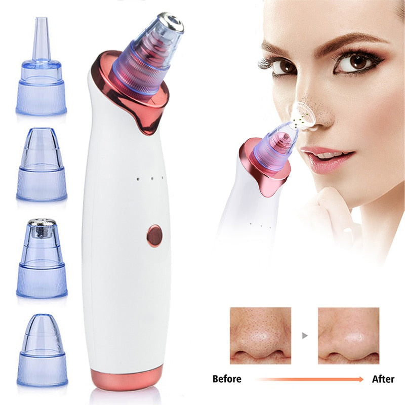 Electric Facial Remover | Blackhead Remover | The Cosmetic Obsession