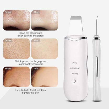 Deep Facial Scrubber | Face Cleaner Scrubber | The Cosmetic Obsession